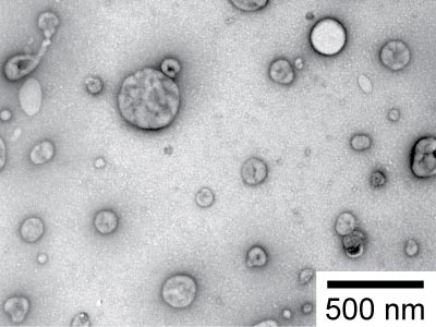 Extracellular vesicles from human urine